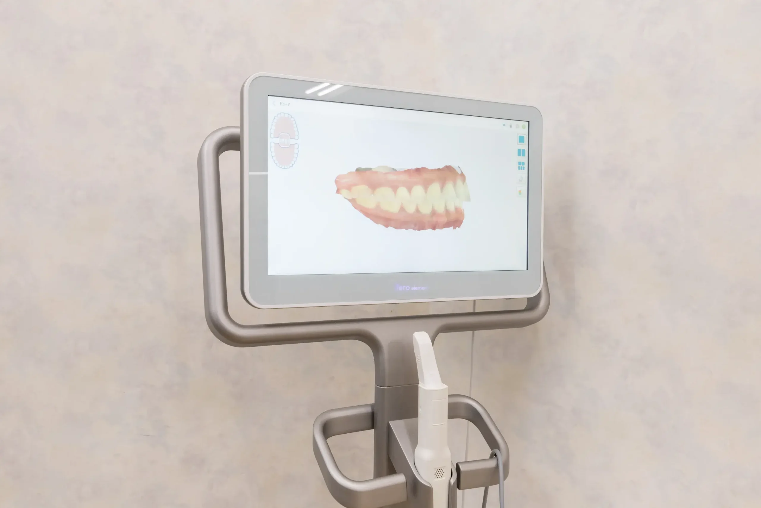 iTeroエレメント